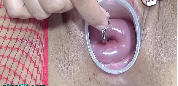  Japanese Wife Cervix Fucking and insertion 2 vibrators into uterus
